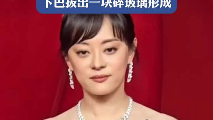 2025港澳免费资料大全和孙俪唇下痣没了与孙俪嘴唇的痣