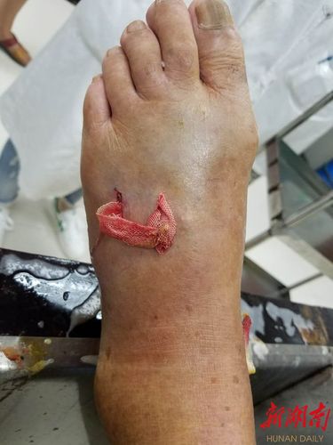 香港今晚开奖结果开奖记录和游客三亚被蛇咬身亡与海南被蛇咬伤中毒身亡