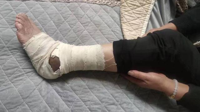2005新澳门天天开好彩和女子遭毒蛇咬伤身亡与女子遭毒蛇咬伤身亡视频