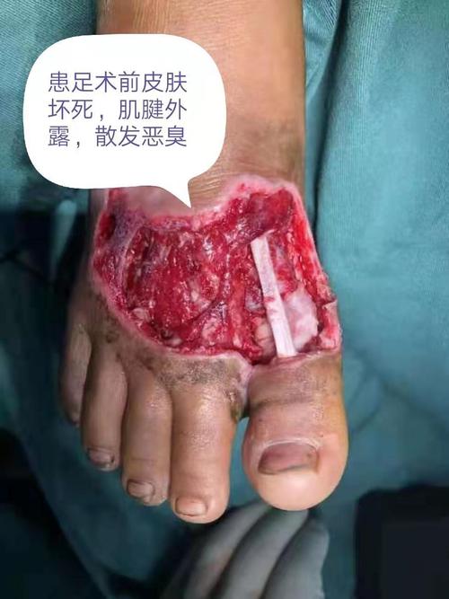 2025新澳门天天开奖记录和女子遭毒蛇咬伤身亡与女子遭毒蛇咬伤身亡视频